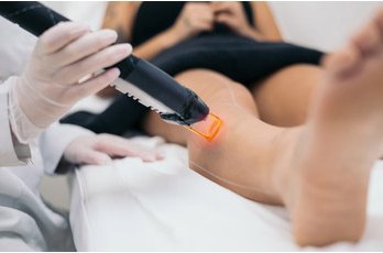 Épilation laser à Toulouse : le guide complet pour hommes et femmes